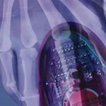X-ray effect